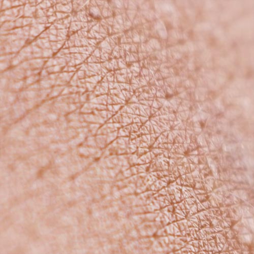 Epidermis Schutzschild unserer Haut